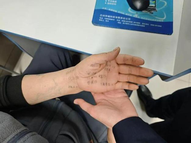 手掌发紫需要警惕的疾病