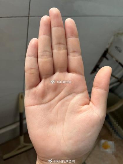 手机调高照片清晰度缩略图