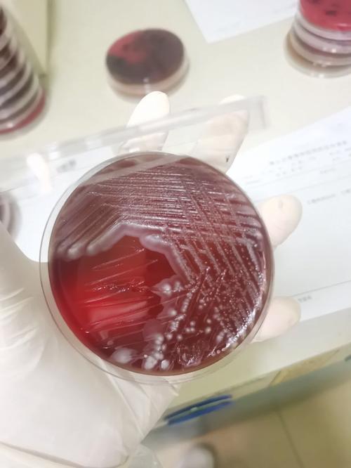 雷氏普罗威登斯菌天然耐药