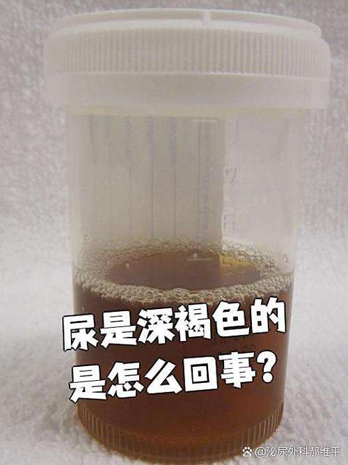 打完消炎针后尿红褐色