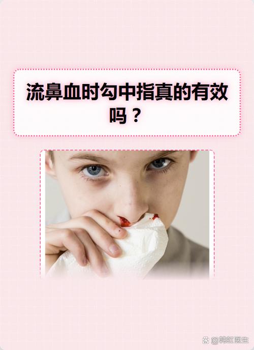 流鼻血特效偏方游戏截图