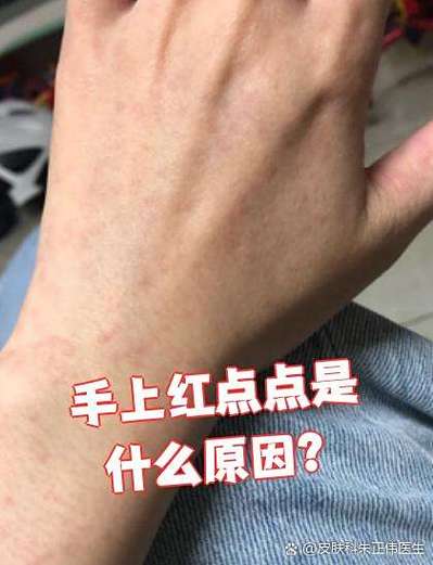 朋友圈有个小红点但是没动态
