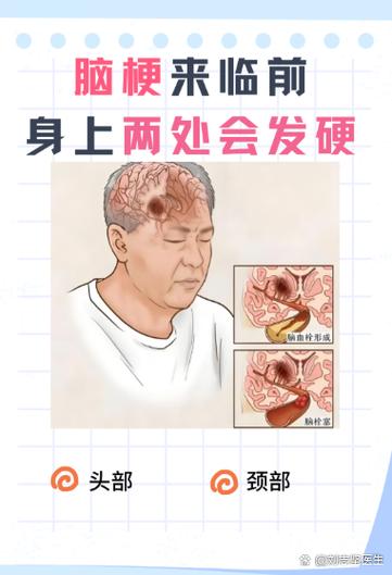 怎么判断自己脑部有问题缩略图