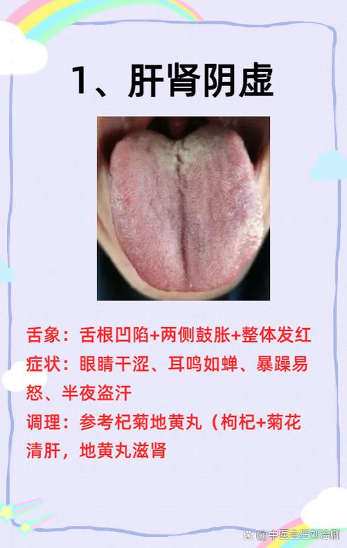 男生困困到女生困困了是肾虚吗图标