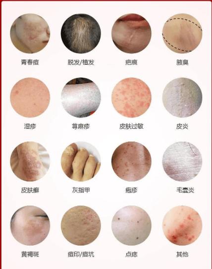 100种皮肤病游戏截图