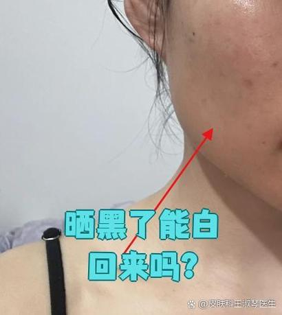变黑了还能白回来吗游戏截图