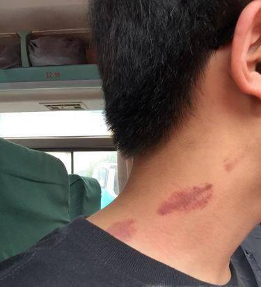 草莓印一直不消缩略图