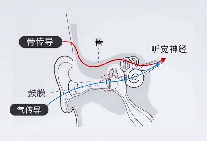 耳机骨传导和气传导哪个好图标