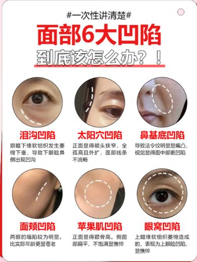 脸部凹陷怎么自己恢复