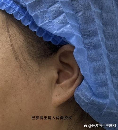 彻底清除app安装痕迹