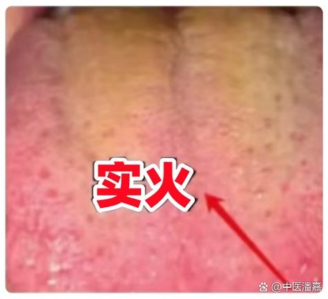 男朋友上火了回复缩略图