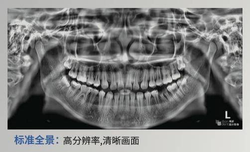 两边牙齿不对称嘴歪有关系吗游戏截图