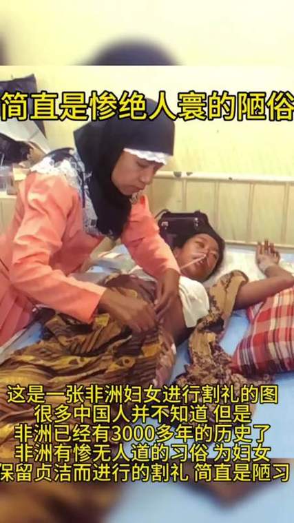 女孩到了割礼时会不会搬开女孩的双