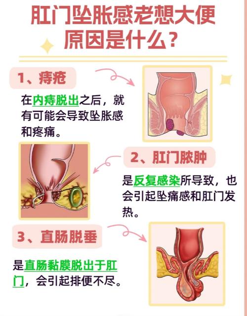 肛门有下坠感的原因游戏截图