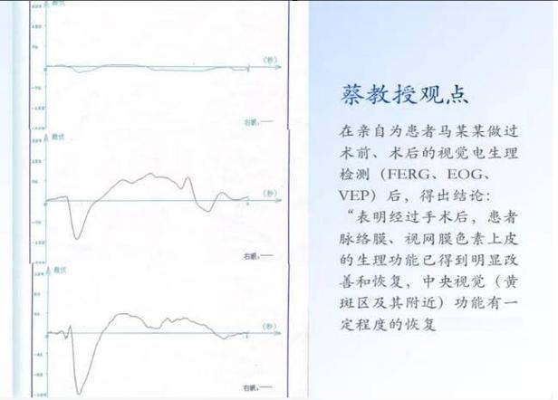 做erg检查需要做什么准备