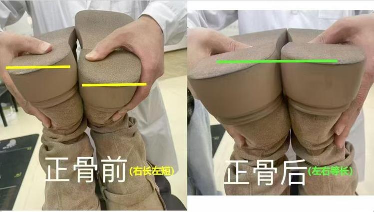 针灸和正骨哪个效果好
