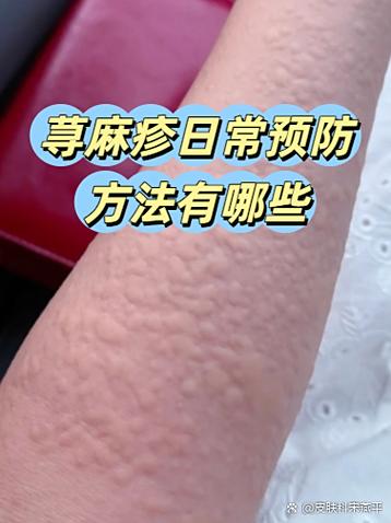 腋窝和大腿根起红疹痒是怎么回事