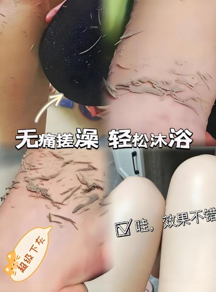 洗澡搓出黄泥是什么原因图标
