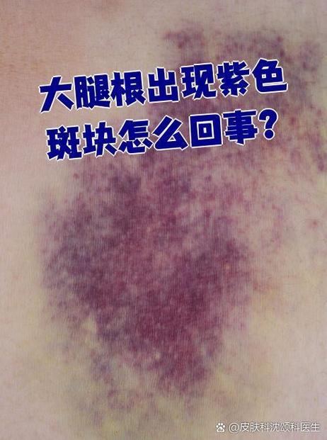 屏幕黑色有紫斑图标