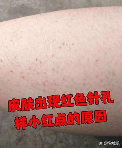 红点怎么设置不显示