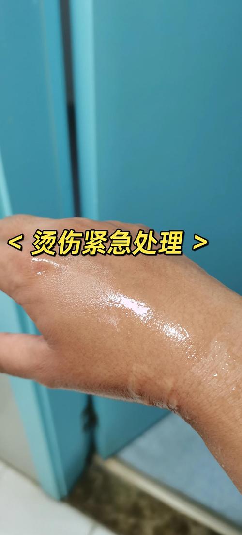 手机屏幕被开水烫了一下会坏吗