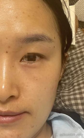 脸上暗黄发黑怎么回事儿缩略图