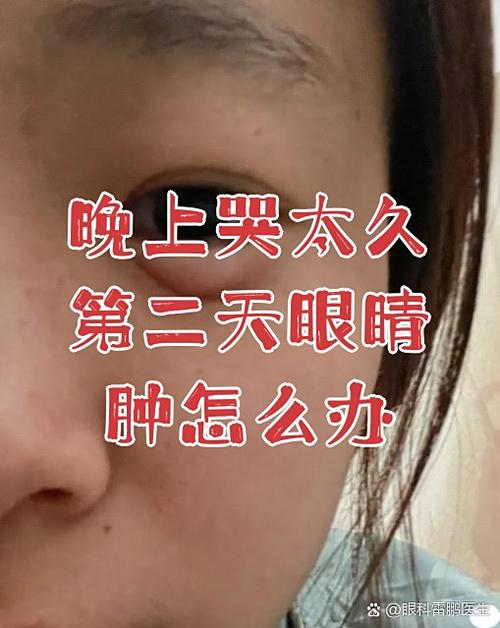 女生眼睛哭肿了怎么安慰缩略图