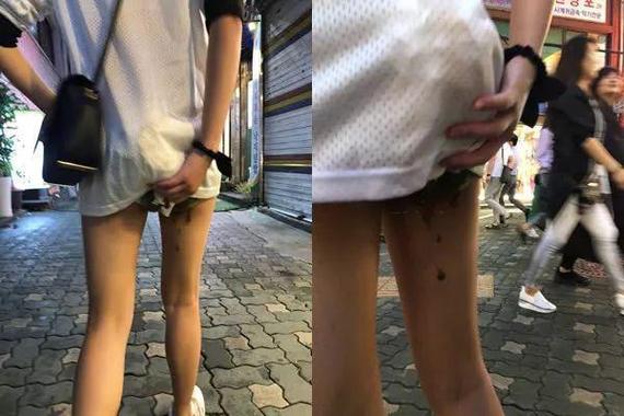 女士大便憋不住拉裤子图标