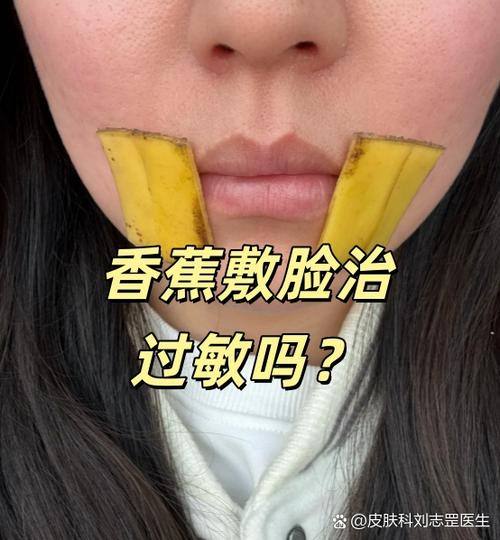 脸过敏发红痒敷香蕉缩略图