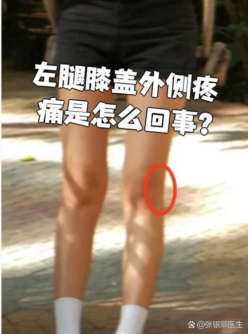 左腿疼痛要警惕三种病症
