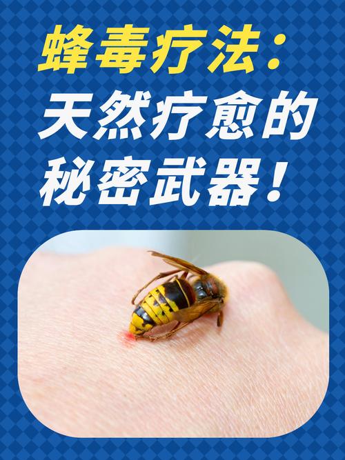 蜂毒免费阅读更新版缩略图