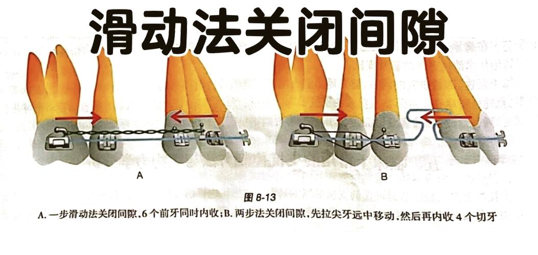 牙不对称容易脸歪缩略图