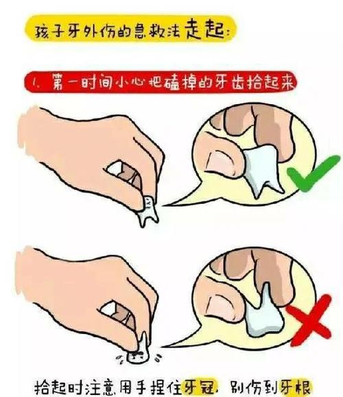 掉一颗牙最好的补救办法
