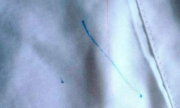 衣服红笔笔迹怎么洗掉缩略图