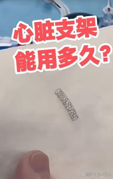 心脏支架能维持多少年