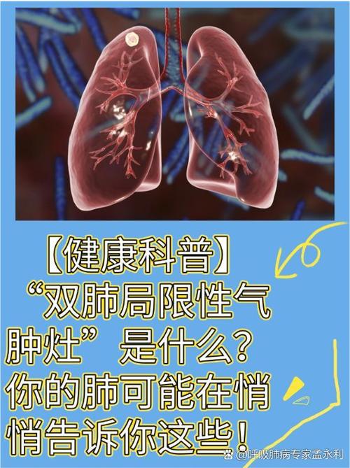 prt医学上指什么图标