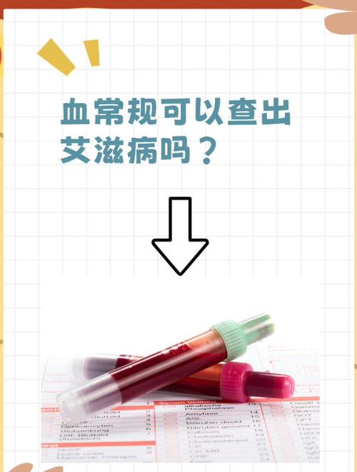 艾滋病抗体会查不出吗图标