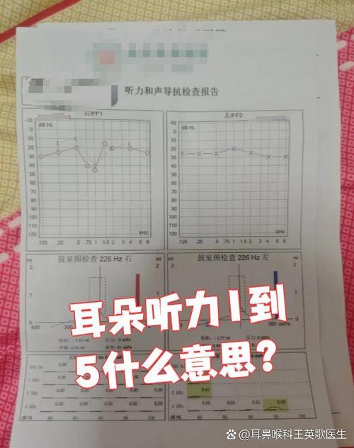蓝牙耳机孔被耳屎堵了缩略图