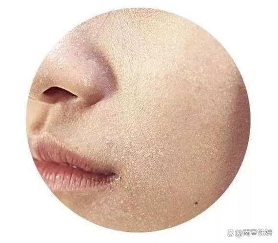 脸上暗黄没有光泽是什么原因游戏截图