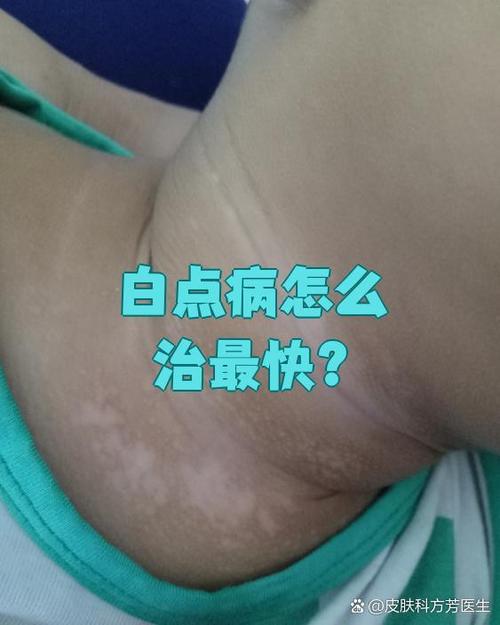 手上白色的小白点凸起图标