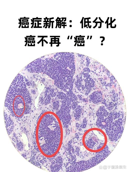 病理恶性是什么意思
