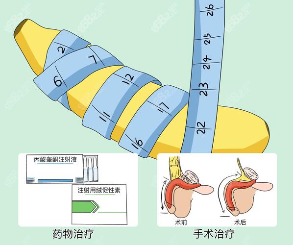 加粗尾与三角尾哪个好图标