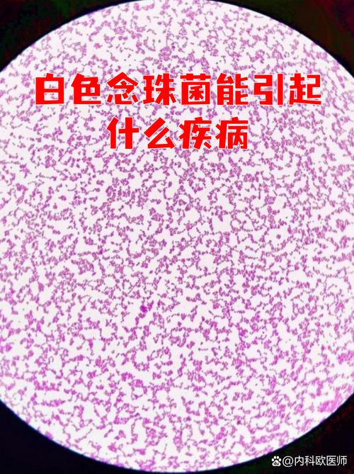 白色念珠菌是什么样子