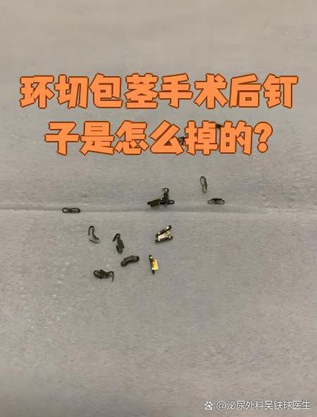 手术钛钉是什么样的图片