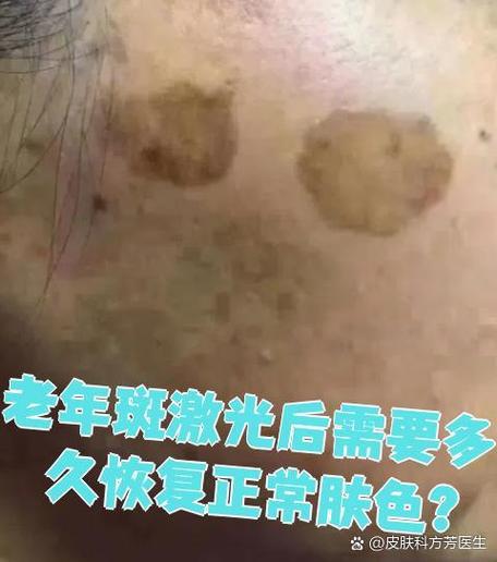 手机屏幕突然出现黑块图标