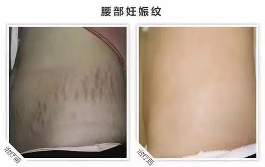手机屏幕有彩色亮斑图标