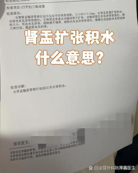 自来水出水量小是什么原因