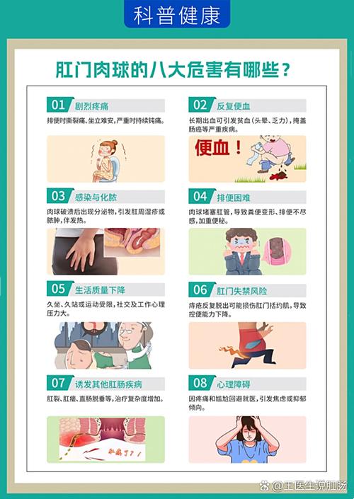 脱肛和内痔脱出的区别游戏截图