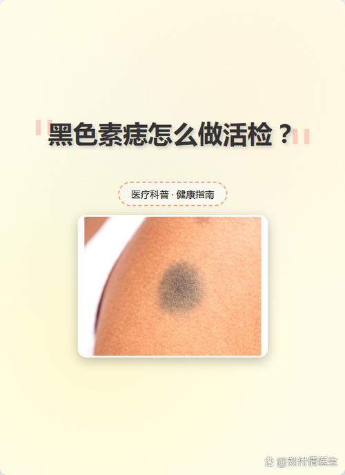 活检意味着什么缩略图