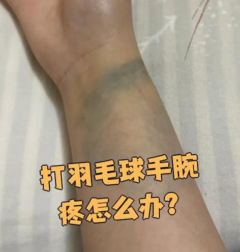 打羽毛球为什么会手腕疼